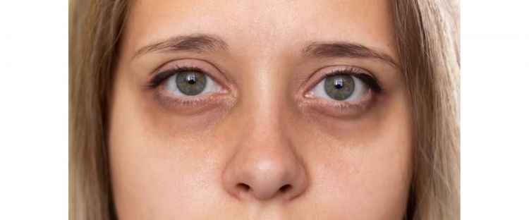 Spray Wajah Guna Timun dan Aloe Vera: Resipi Membuat Wajah Cicak Cantik dan Seimbang