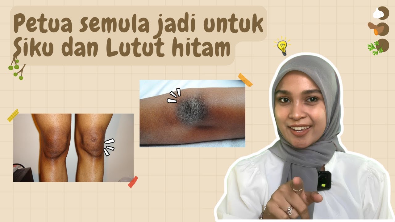 Petua Cerahkan Siku & Lutut Secara Semula Jadi Petua Cerahkan Siku & Lutut Secara Semula Jadi