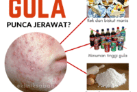 Kesan Gula Berlebihan Terhadap Jerawat Kesan Gula Berlebihan Terhadap Jerawat